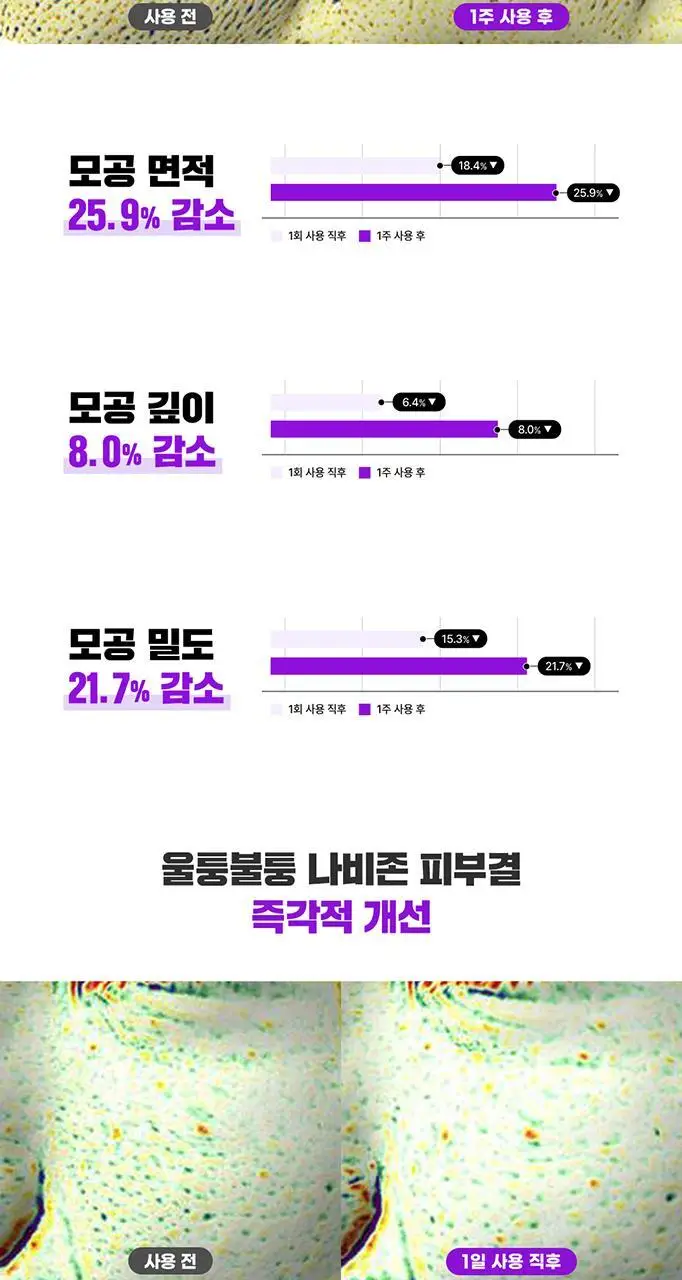 [단독기획/대용량] 파티온 노스카나인 트러블 모공탄력 세럼 50ml 기획(+5ml+크림 5ml) 상세페이지 19